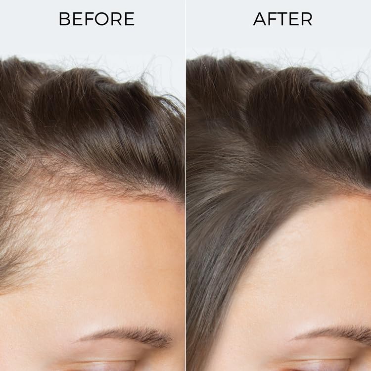 Brillare - 100% Rosemary Essential Oil For Hair Growth 15ml - Nexus hair