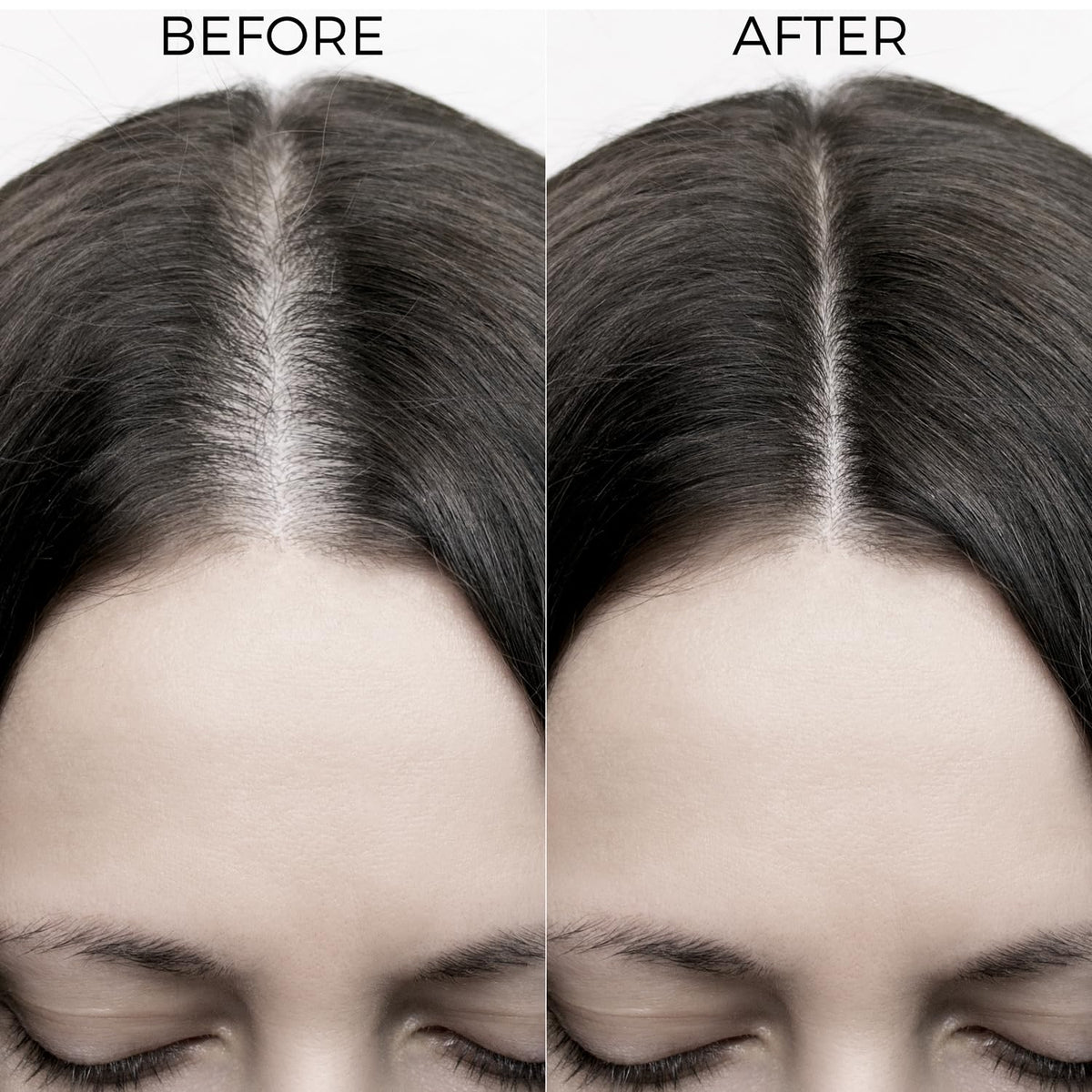 Brillare - Onion & Bakuchiol Oil Shots For Hair Fall Reduction 6ml X 8 - Nexus hair